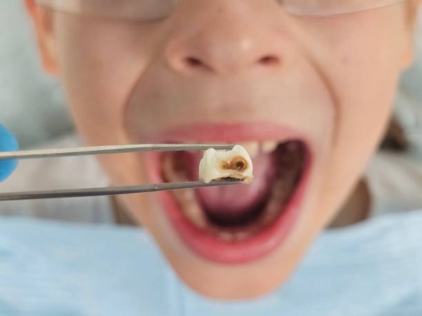 Best Weekend Emergency Dentist in North Muskegon, MI